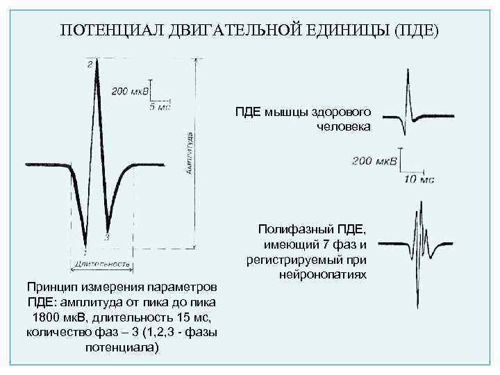 ПОТЕНЦИАЛ ДВИГАТЕЛЬНОЙ ЕДИНИЦЫ (ПДЕ) ПДЕ мышцы здорового человека Принцип измерения параметров ПДЕ: амплитуда от