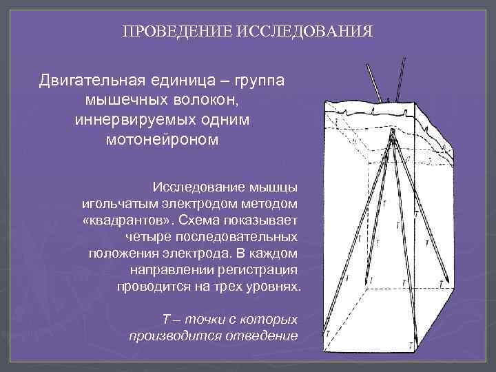 ПРОВЕДЕНИЕ ИССЛЕДОВАНИЯ Двигательная единица – группа мышечных волокон, иннервируемых одним мотонейроном Исследование мышцы игольчатым