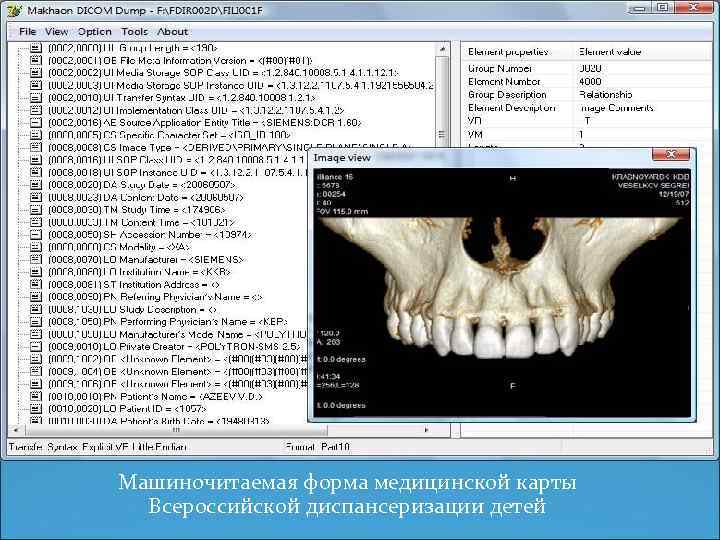 Машиночитаемая форма медицинской карты Всероссийской диспансеризации детей 