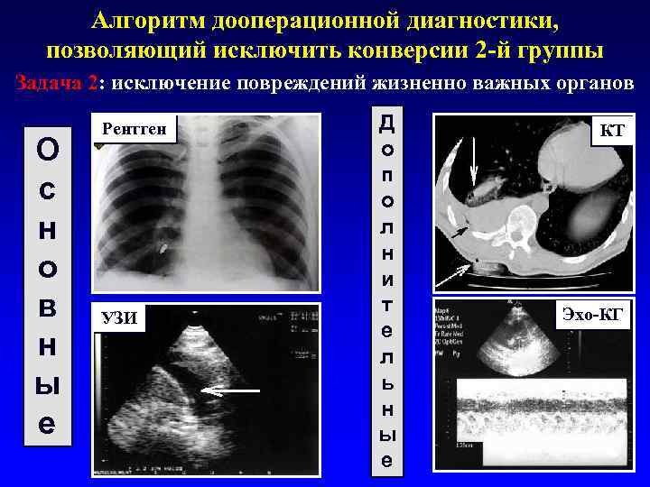 Алгоритм дооперационной диагностики, позволяющий исключить конверсии 2 -й группы Задача 2: исключение повреждений жизненно