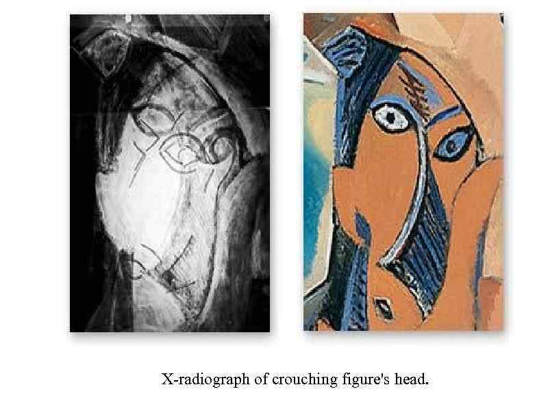 X-radiograph of crouching figure's head. 