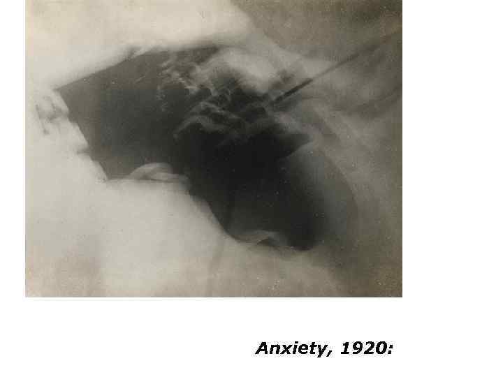 Anxiety, 1920: 