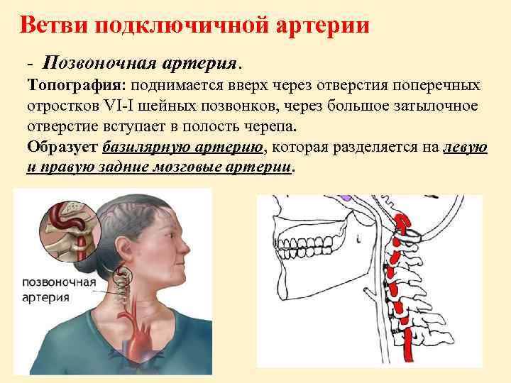 Ветви подключичной артерии - Позвоночная артерия. Топография: поднимается вверх через отверстия поперечных отростков VI-I