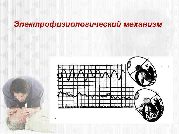 Электрофизиологический механизм 