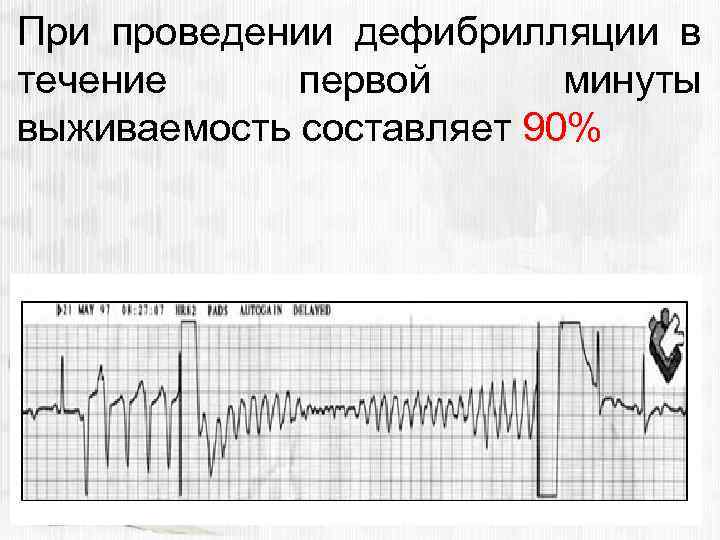 При проведении дефибрилляции в течение первой минуты выживаемость составляет 90% 