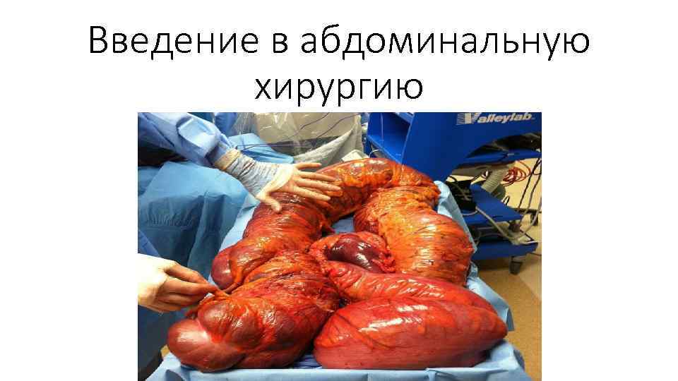 Введение в абдоминальную хирургию 