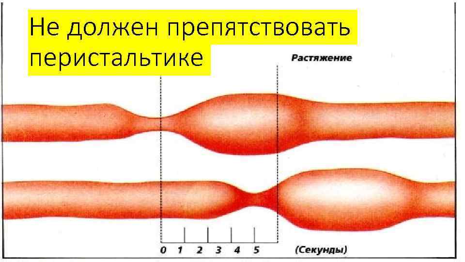 Не должен препятствовать перистальтике 