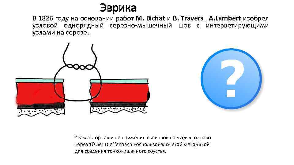 Эврика В 1826 году на основании работ M. Bichat и В. Travers , A.