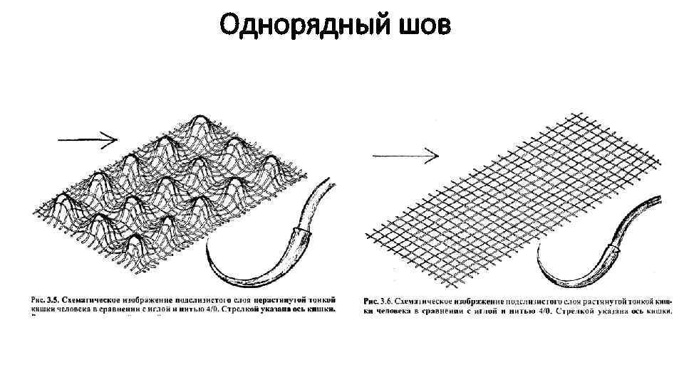 Однорядный шов 