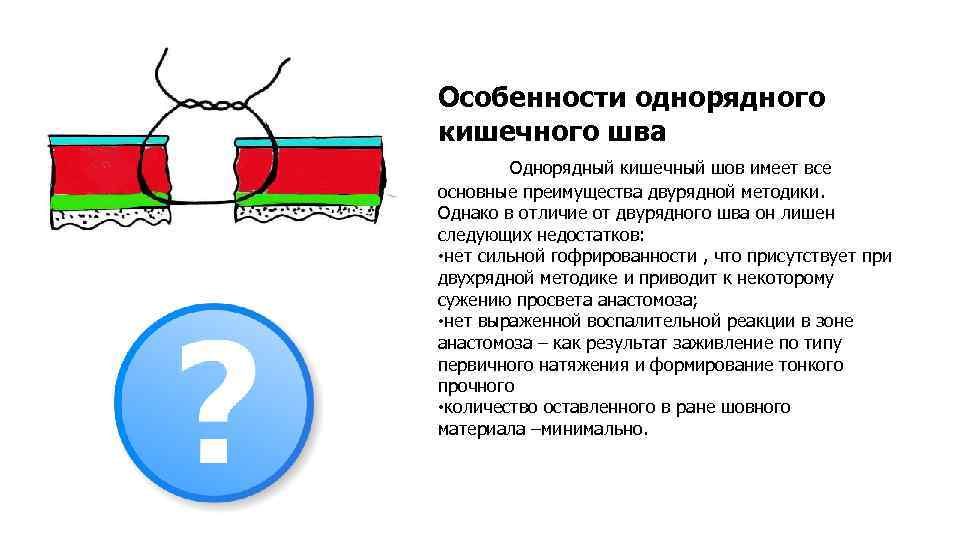 Особенности однорядного кишечного шва Однорядный кишечный шов имеет все основные преимущества двурядной методики. Однако