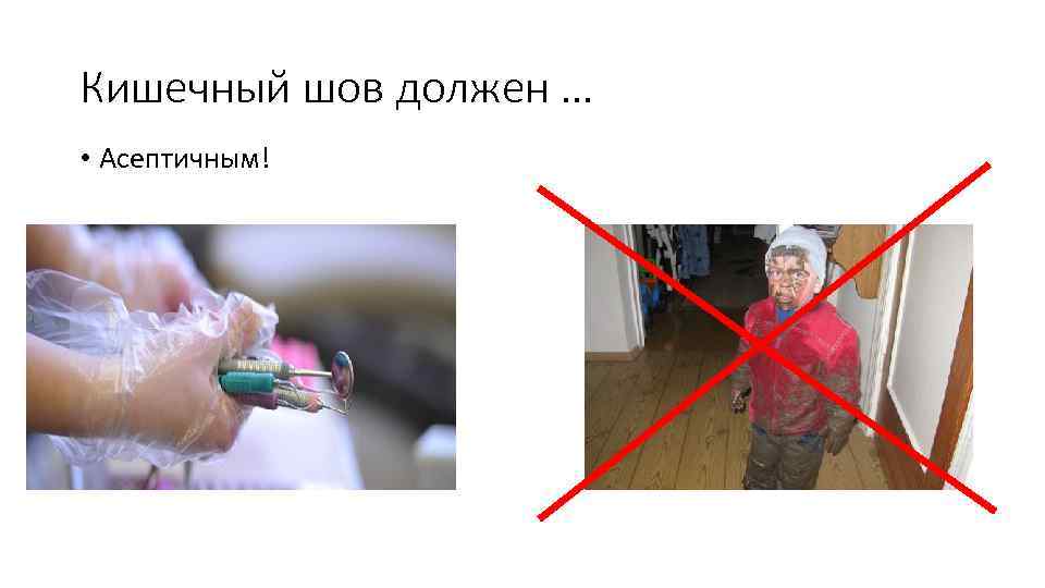 Кишечный шов должен … • Асептичным! 