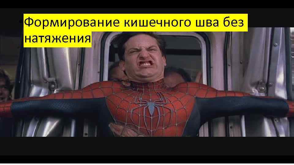  • Формирование кишечного шва без натяжения 