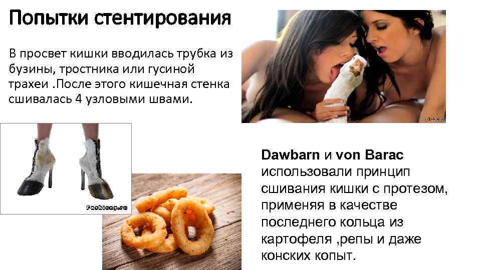 Попытки стентирования В просвет кишки вводилась трубка из бузины, тростника или гусиной трахеи. После