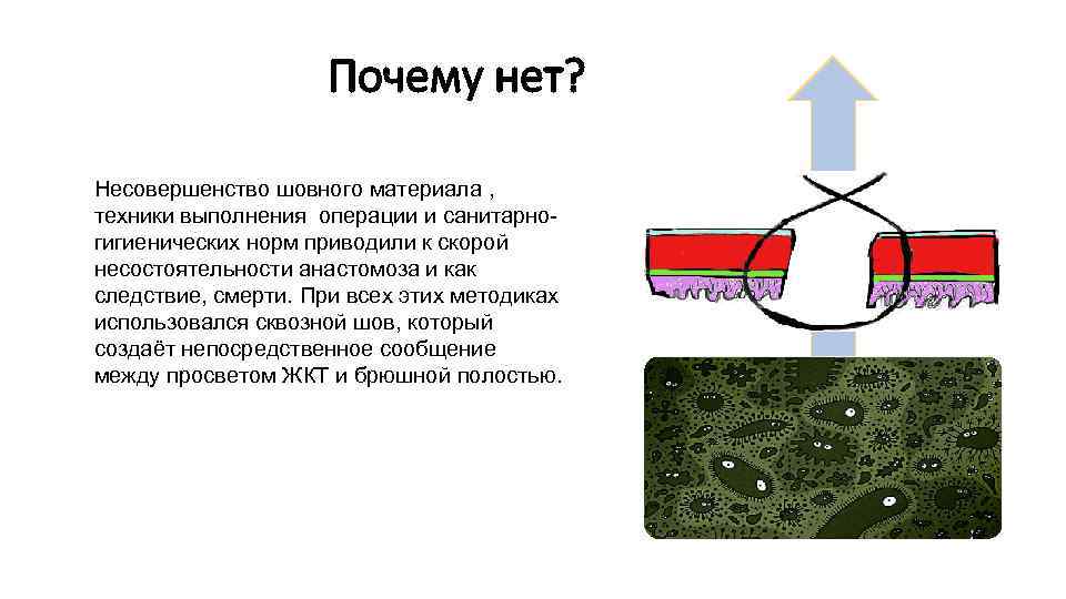 Почему нет? Несовершенство шовного материала , техники выполнения операции и санитарногигиенических норм приводили к