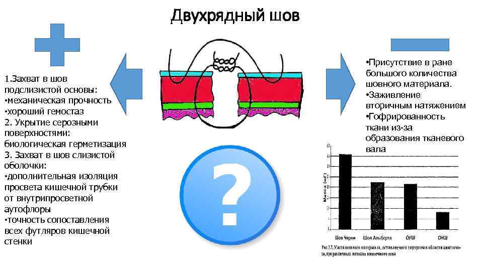 Двухрядный шов 1. Захват в шов подслизистой основы: • механическая прочность • хороший гемостаз