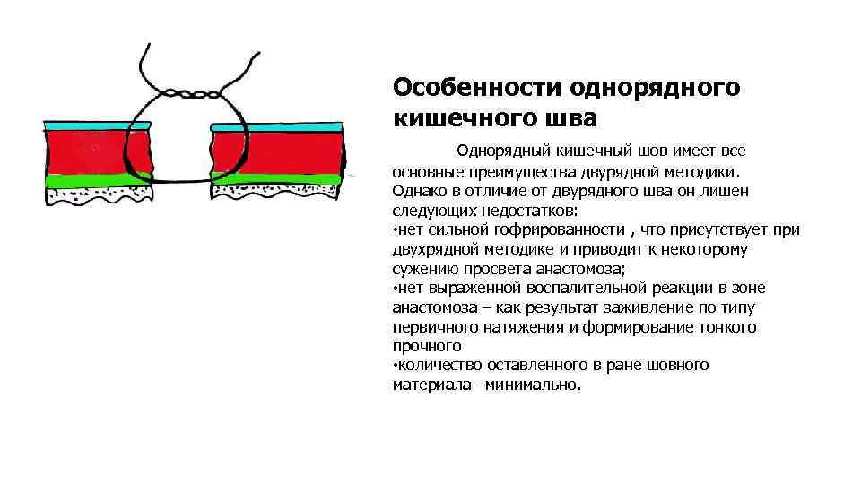 Особенности однорядного кишечного шва Однорядный кишечный шов имеет все основные преимущества двурядной методики. Однако