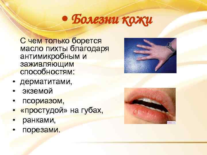  • Болезни кожи • • • С чем только борется масло пихты благодаря