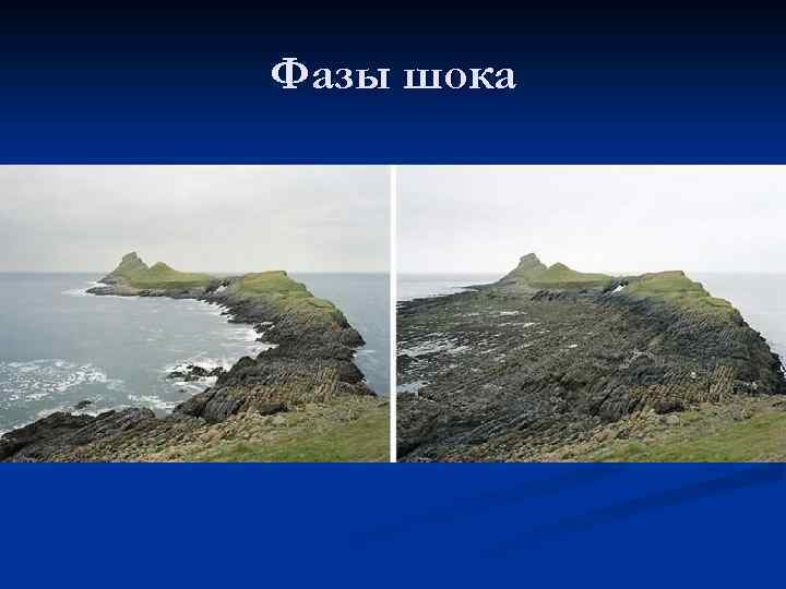 Фазы шока 