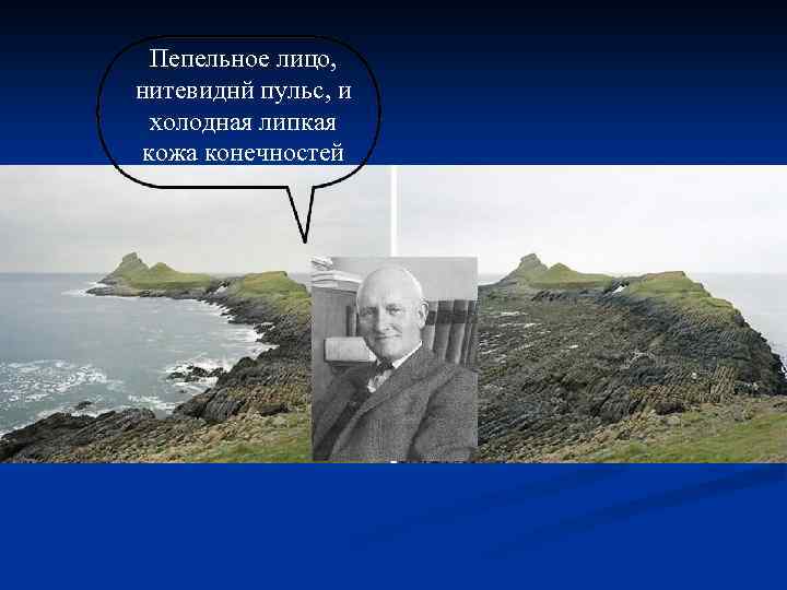 Пепельное лицо, нитевиднй пульс, и холодная липкая кожа конечностей 
