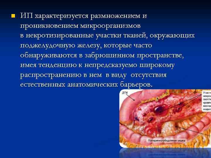 n ИП характеризуется размножением и проникновением микроорганизмов в некротизированные участки тканей, окружающих поджелудочную железу,