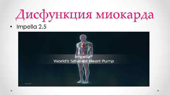 Дисфункция миокарда • Impella 2. 5 