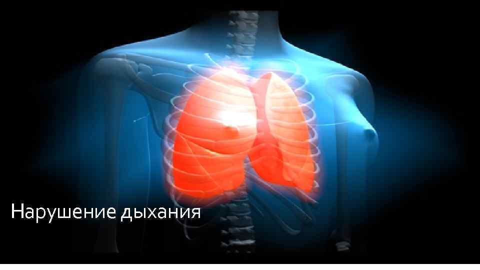 Нарушение дыхания 