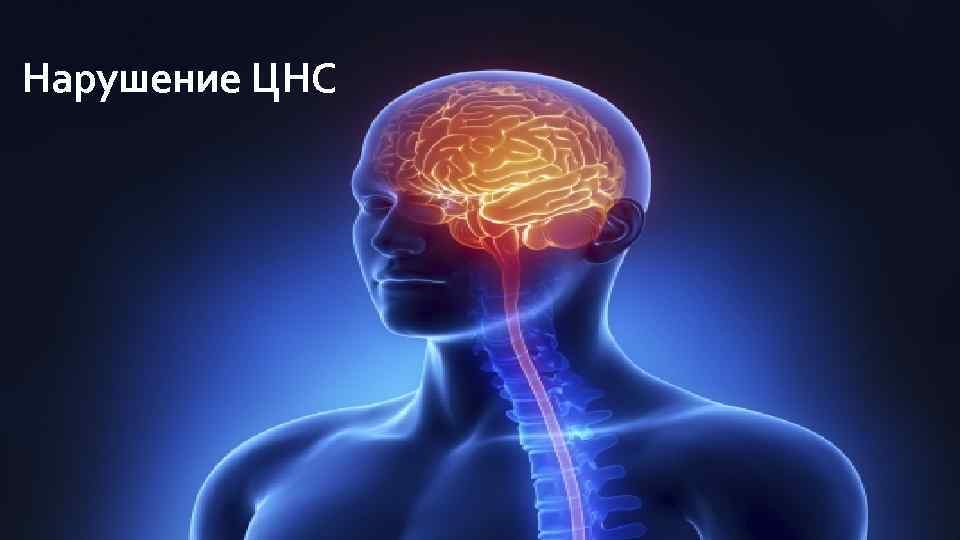 Нарушение ЦНС 