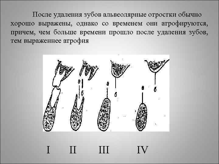 После удаления зубов альвеолярные отростки обычно хорошо выражены, однако со временем они атрофируются, причем,