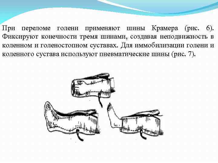 Открытый перелом голени карта вызова