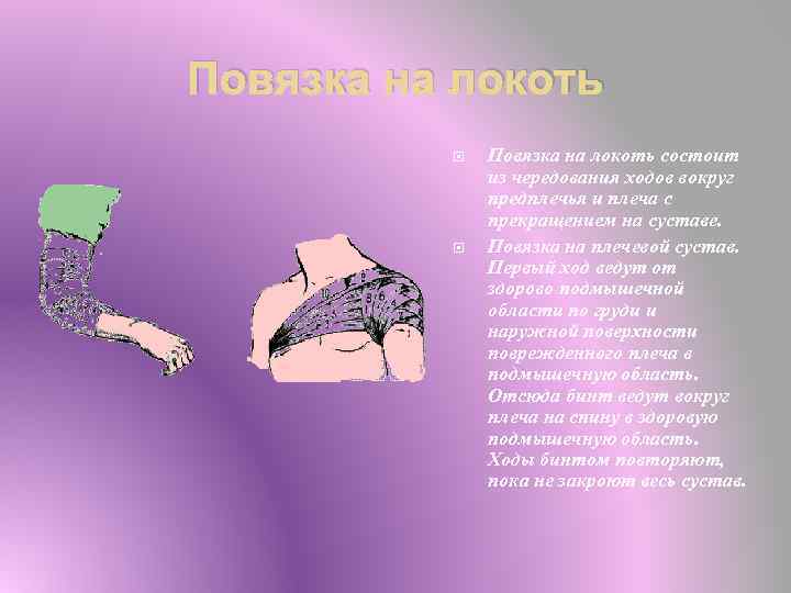 Повязка на локоть состоит из чередования ходов вокруг предплечья и плеча с прекращением на