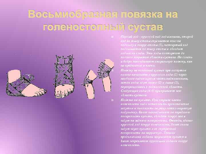 Восьмиобразная повязка на голеностопный сустав Первый ход - круговой над лодыжками, второй ход по