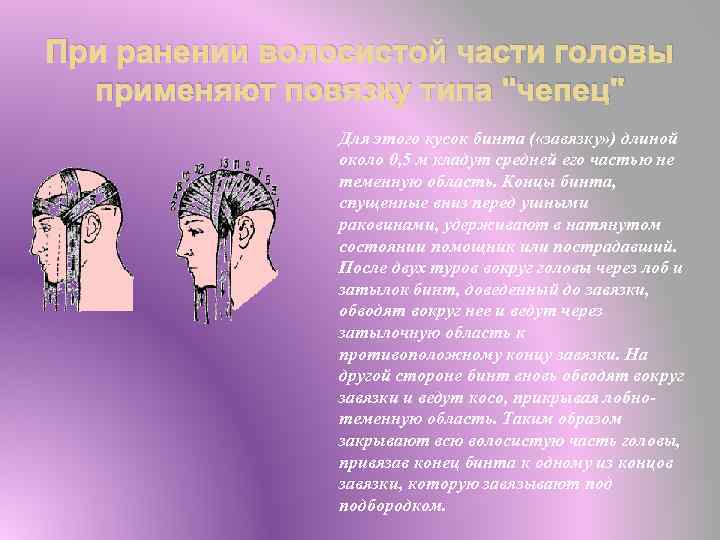 При ранении волосистой части головы применяют повязку типа "чепец" Для этого кусок бинта (