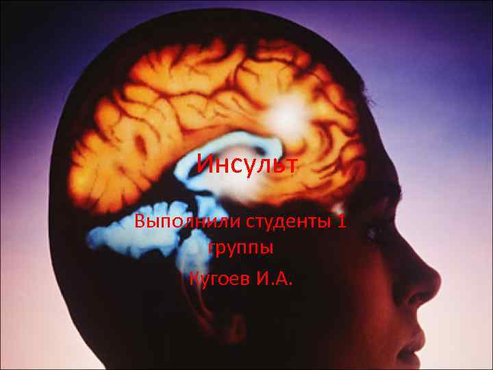 Инсульт Выполнили студенты 1 группы Кугоев И. А. 