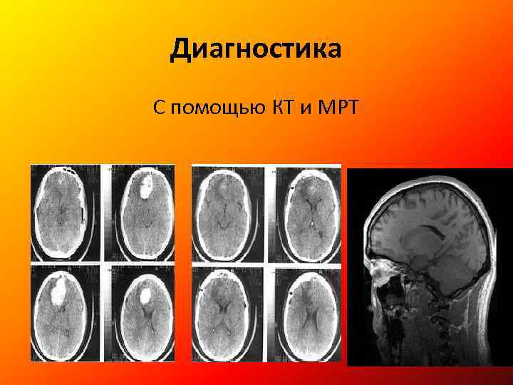 Диагностика С помощью КТ и МРТ 