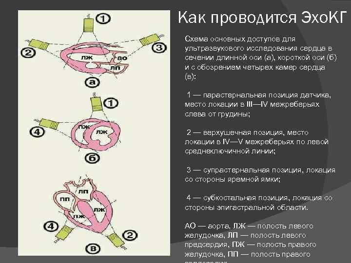 Узи сердца схема