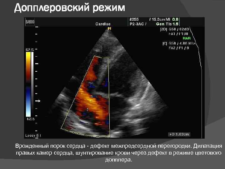 Узи сердца фото результатов