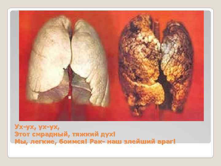 Ух-ух, ух-ух, Этот смрадный, тяжкий дух! Мы, легкие, боимся! Рак- наш злейший враг! 