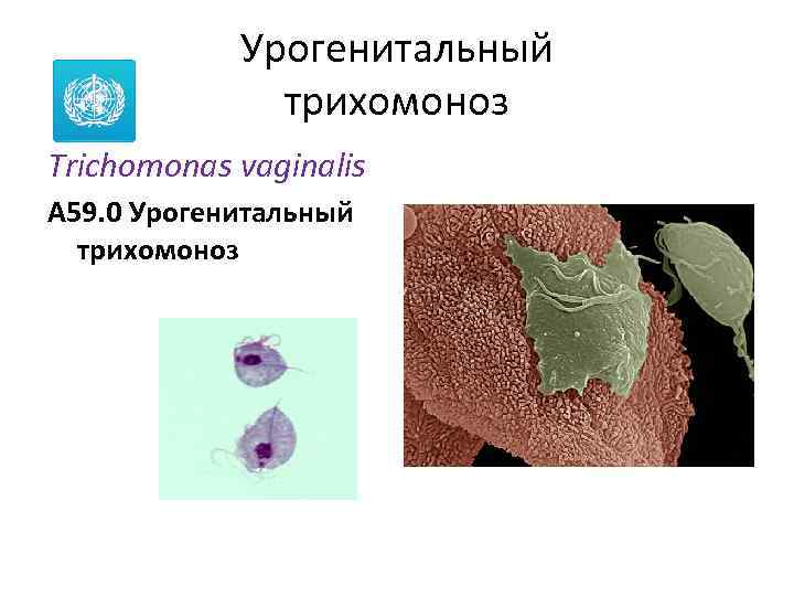 Урогенитальный трихомоноз Trichomonas vaginalis A 59. 0 Урогенитальный трихомоноз 