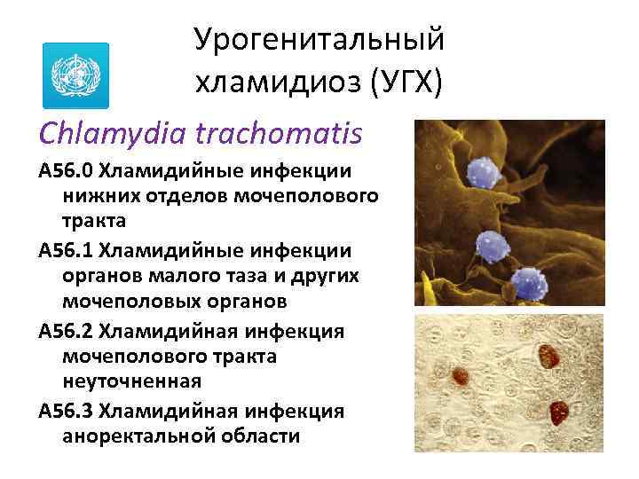 Урогенитальный хламидиоз (УГХ) Chlamydia trachomatis A 56. 0 Хламидийные инфекции нижних отделов мочеполового тракта