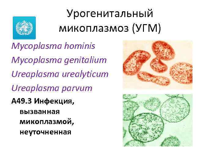 Урогенитальный микоплазмоз (УГМ) Mycoplasma hominis Mycoplasma genitalium Ureaplasma urealyticum Ureaplasma parvum A 49. 3