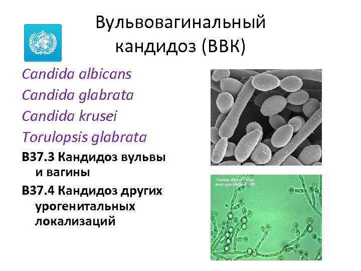 Вульвовагинальный кандидоз (ВВК) Candida albicans Candida glabrata Candida krusei Torulopsis glabrata B 37. 3