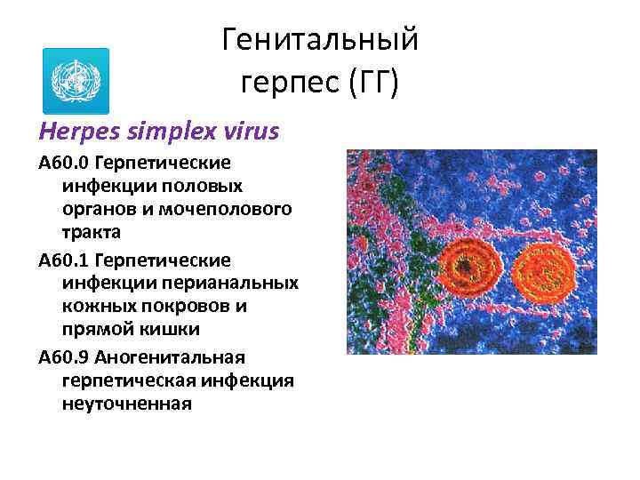 Генитальный герпес (ГГ) Herpes simplex virus A 60. 0 Герпетические инфекции половых органов и