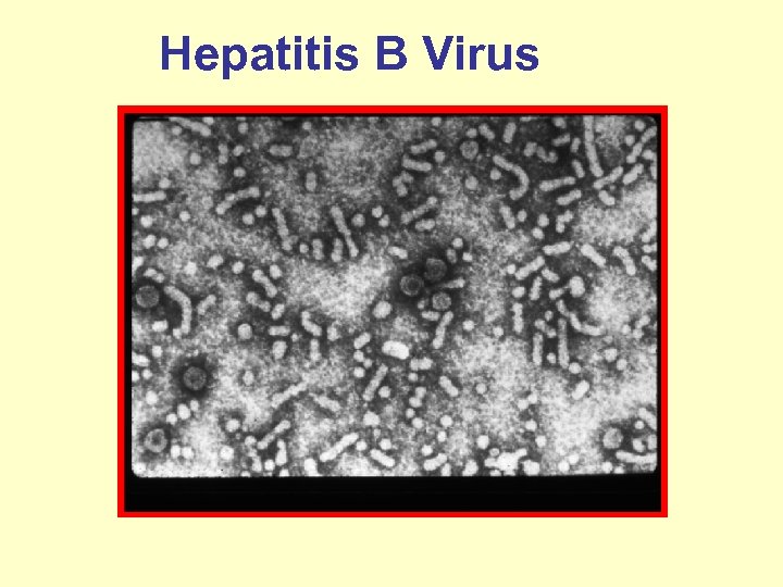 Hepatitis B Virus 