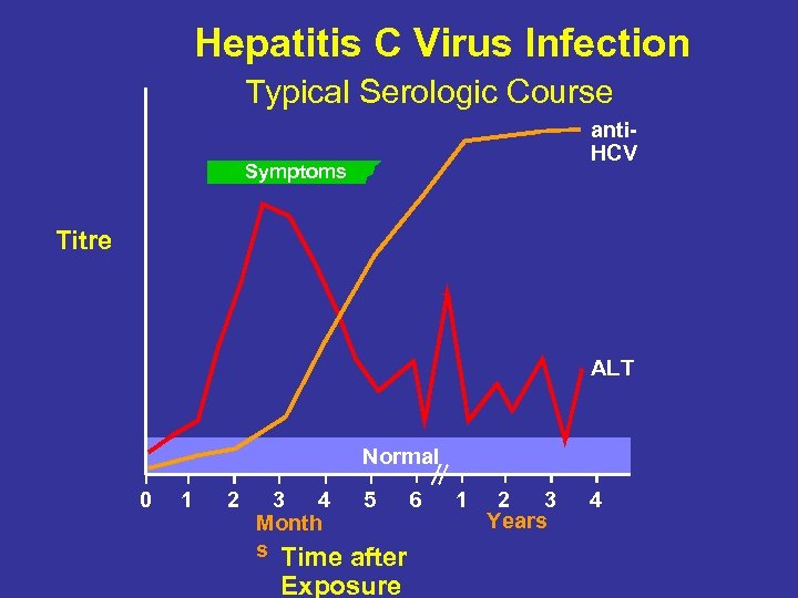 Hepatitis C Virus Infection Typical Serologic Course anti. HCV Symptoms Titre ALT Normal 0