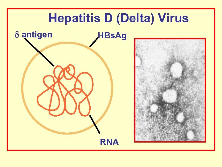 Hepatitis D (Delta) Virus antigen HBs. Ag RNA 