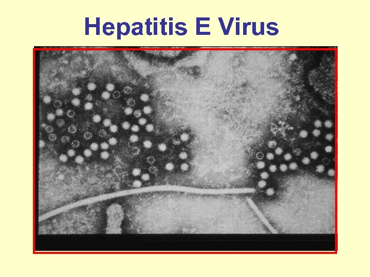 Hepatitis E Virus 