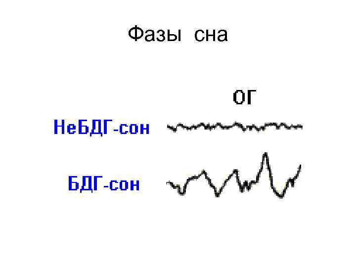 Фазы сна 