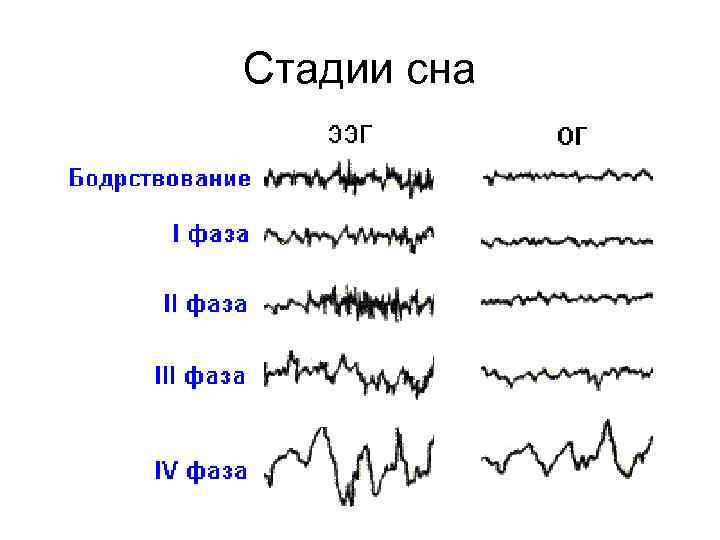 Стадии сна 