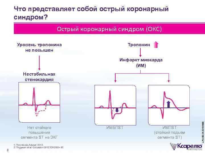 Уровни окс