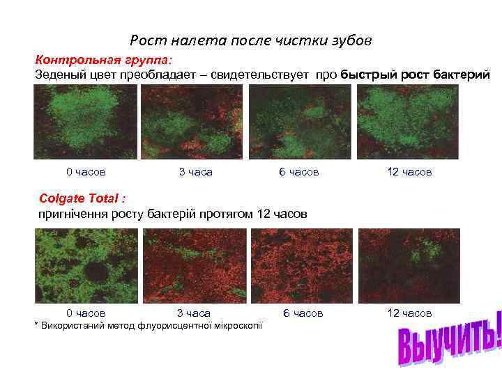 Рост налета после чистки зубов Контрольная группа: Зеденый цвет преобладает – свидетельствует про быстрый
